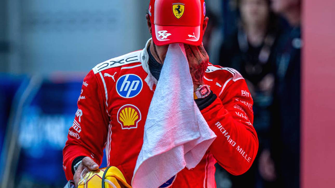 Lewis Hamilton ist nach dem Rennen gezeichnet
