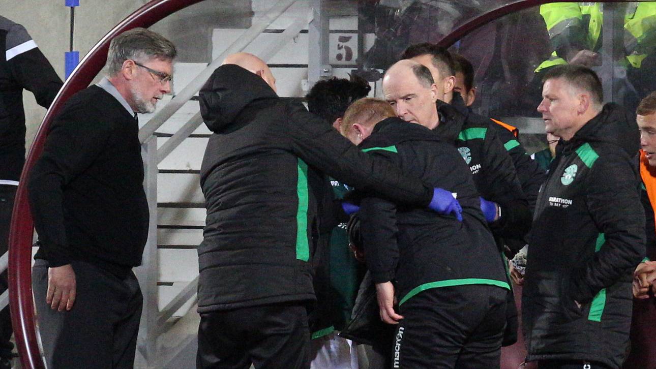 Hibs-Trainer mit Münze beworfen