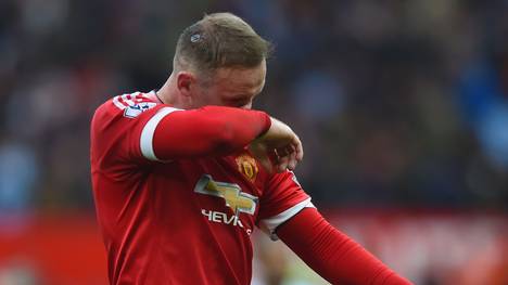 Wayne Rooney zog sich im Manchester-Derby eine blutende Platzwunde am Kopf zu