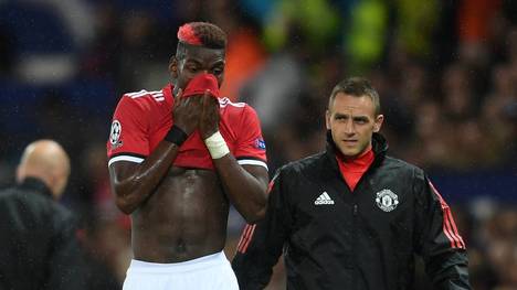 Manchester United muss wohl langfristig auf Paul Pogba verzichten