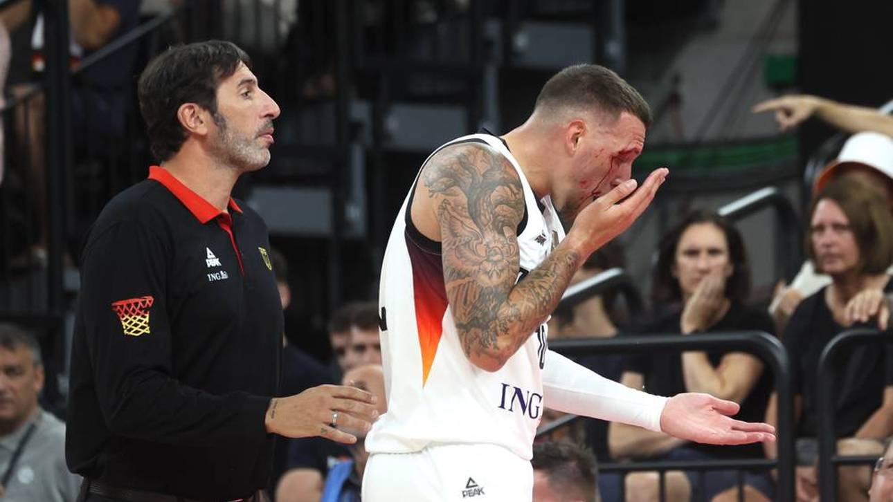 Daniel Theis zog sich eine Platzwunde zu