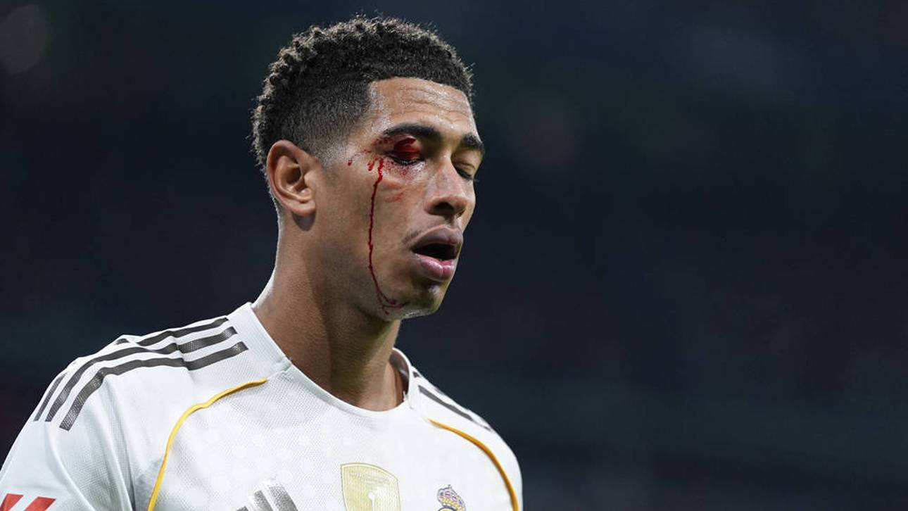 Schreckmoment um Bellingham