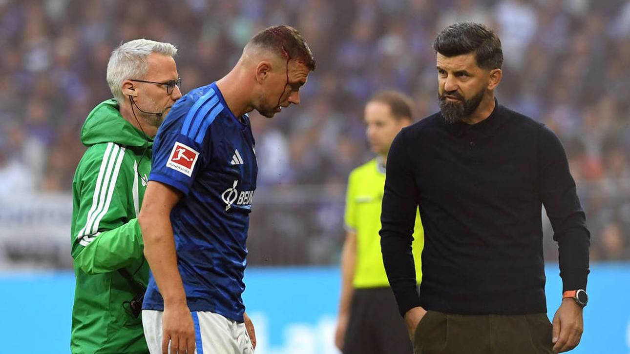 Blut-Schock! Dzeko mit Platzwunde ausgewechselt
