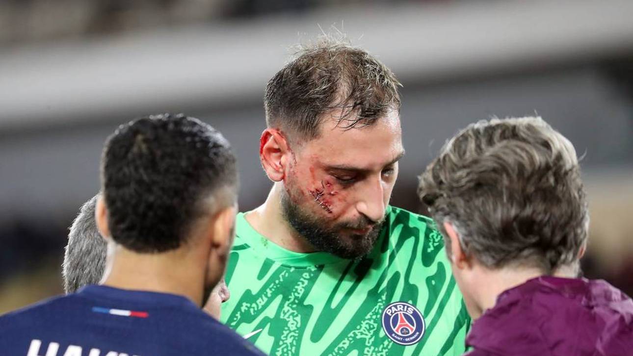 Gianluigi Donnarumma verletzte sich im Gesicht