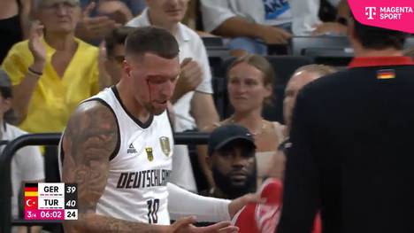 Beim Supercup-Spiel zwischen Deutschland und der Türkei kommt es nach einem Zusammenprall der deutschen Basketball-Stars Daniel Theis und Isaac Bonga zu einem blutigen Schreckmoment.