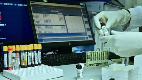 Die WADA sperrt ein Anti-Doping-Labor in Indien
