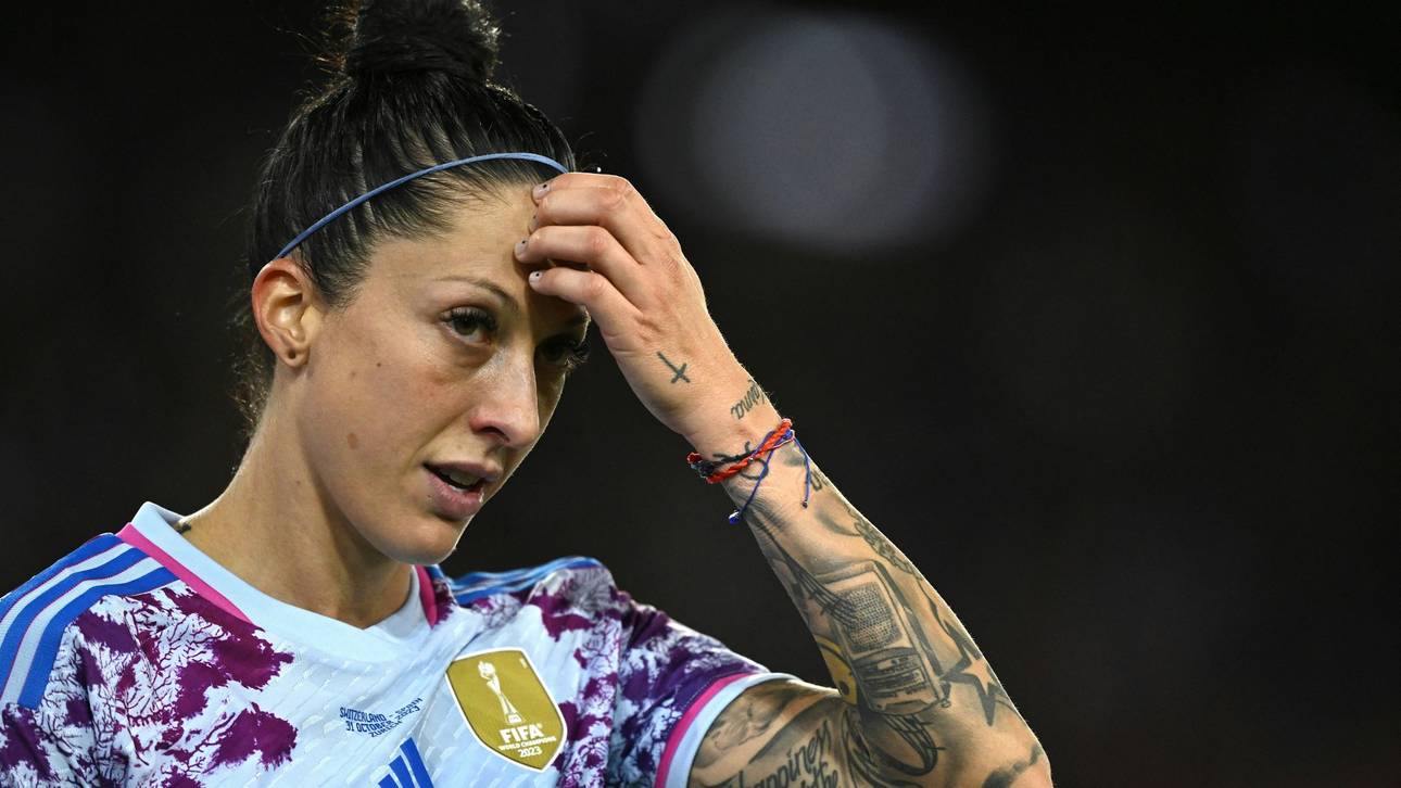 Hermoso kritisiert Nationalcoach