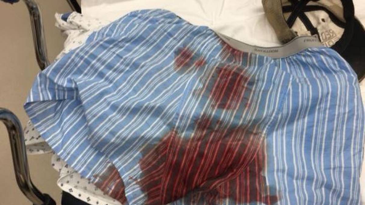 Ein Foto mit Details wollte er nicht posten, stattdessen zeigte er seine blutige Unterhose. Daraufhin kündigte eine Unterwäschen-Marke bereits an, ihm Ersatzteile zu schicken