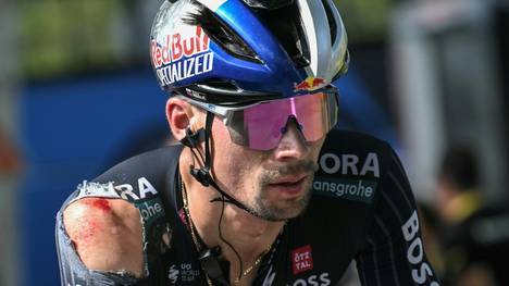 Primoz Roglic mit den Spuren des Sturzes