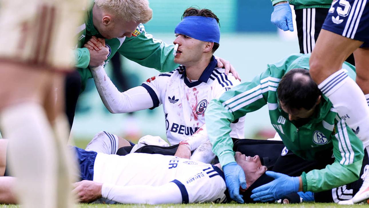 Blut-Crash: Schalke verkündet Doppel-Diagnose