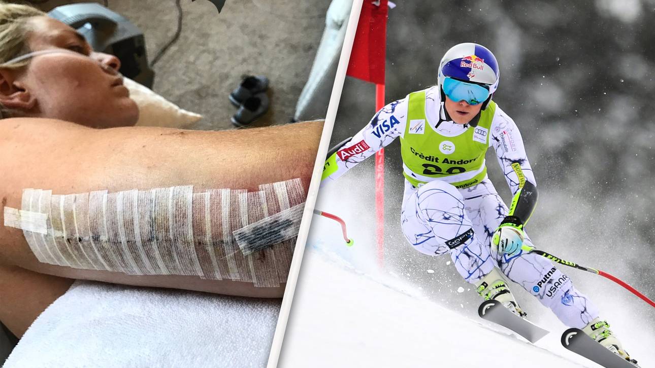 Vonn: Spekulation um Blitz-Comeback