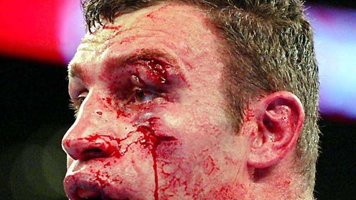 Das Ende ist jedoch nicht sehr ruhmreich. Nachdem sich Klitschko eine mächtige Platzwunde einfängt, empfiehlt der Ringarzt den Kampf abzubrechen - der Ringrichter kommt dem nach und stoppt den Kampf in der sechsten Runde