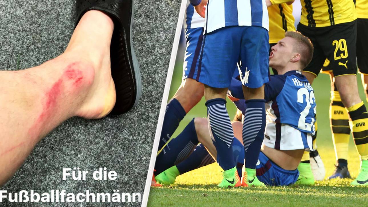 Shitstorm: Weiser wehrt sich