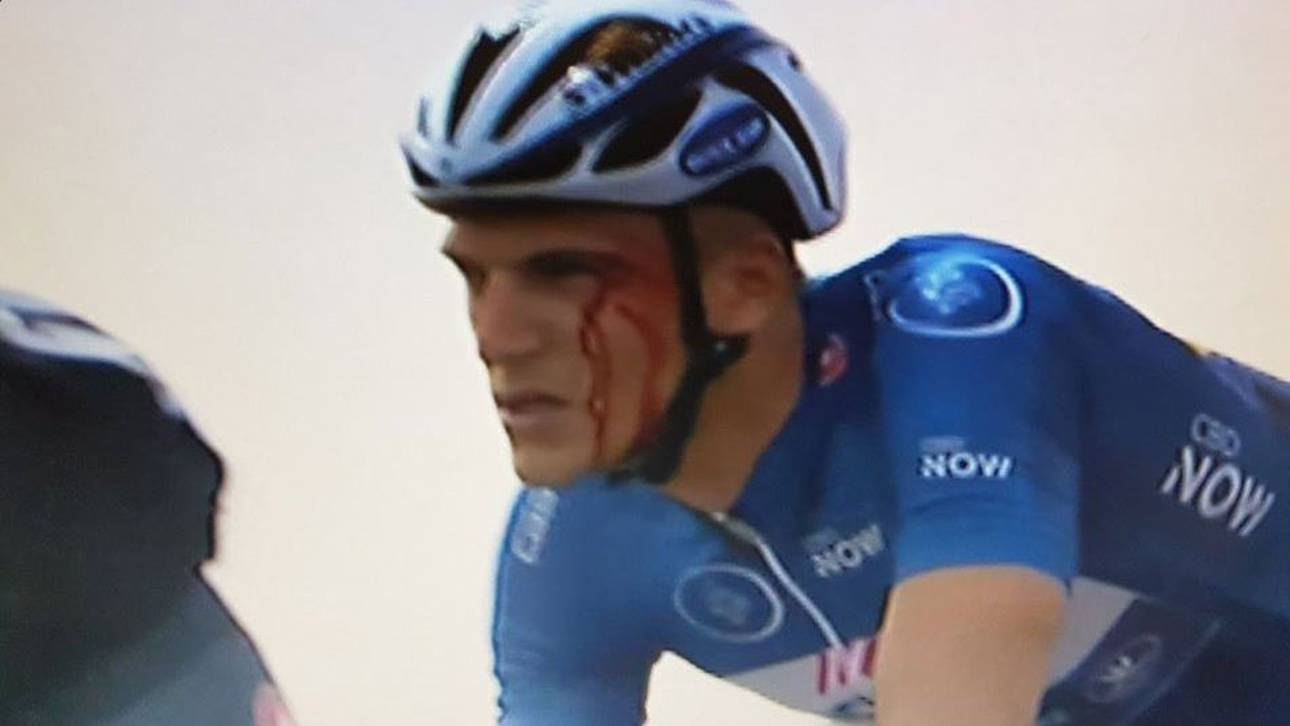 Eklat um blutenden Kittel in Dubai
