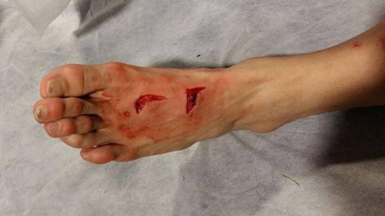 Herreras Verletzung schockt Porto