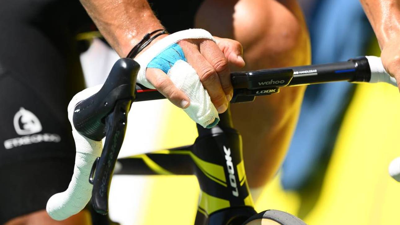 Nach Fingerbruch! Tour-Aus für Coquard