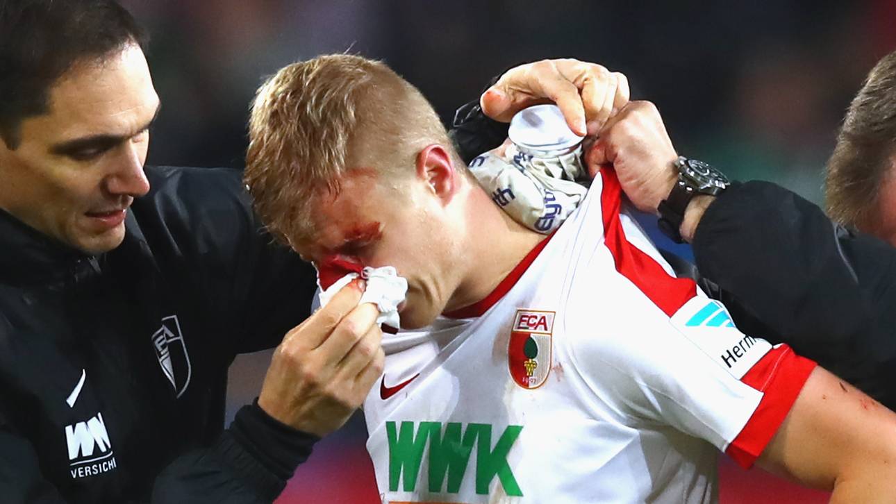 Hinteregger erleidet Nasenbeinbruch