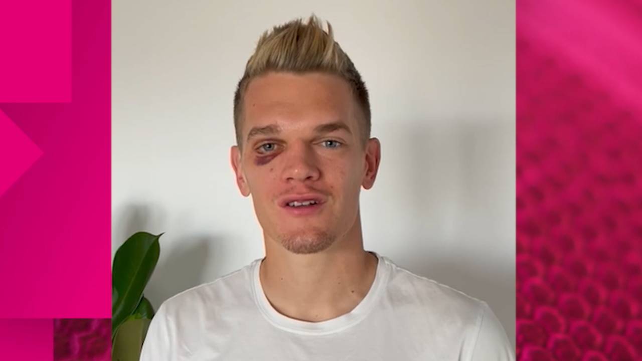 EuroBasket: Kroos, Hummels & Co drücken dem DBB-Team die Daumen im Viertelfinale
