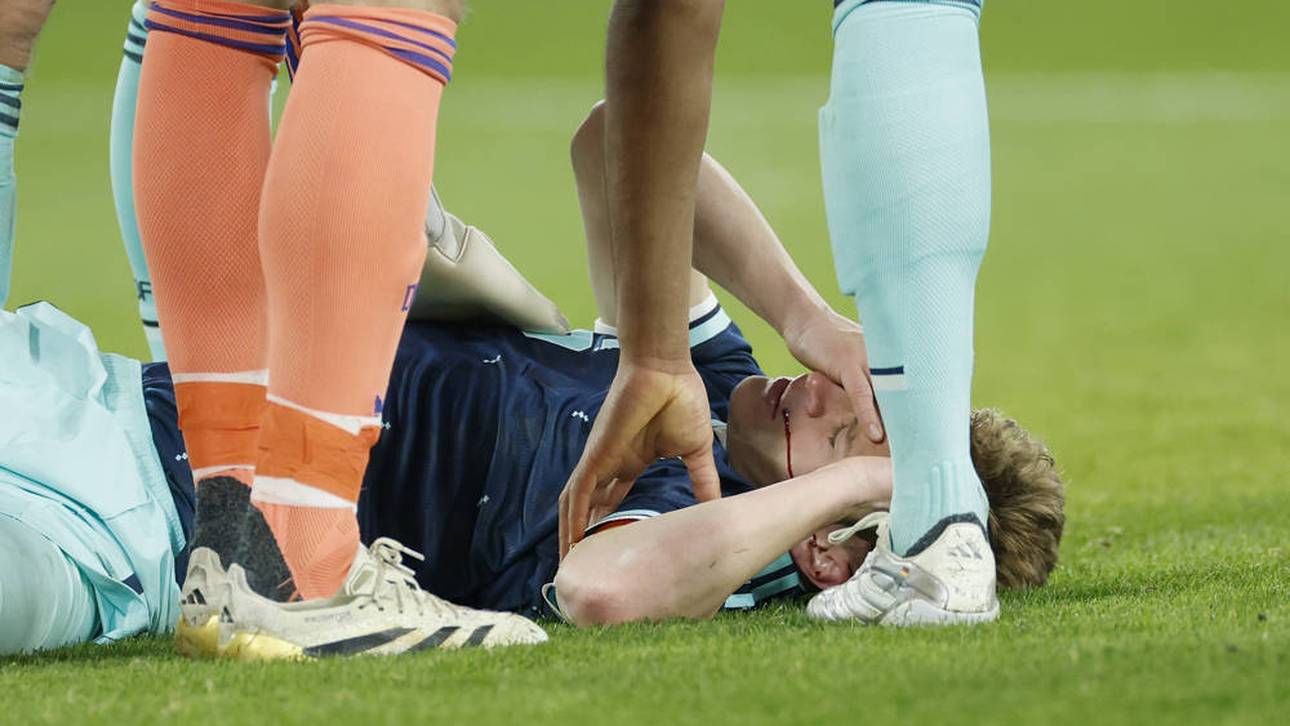 Kimmich hart getroffen