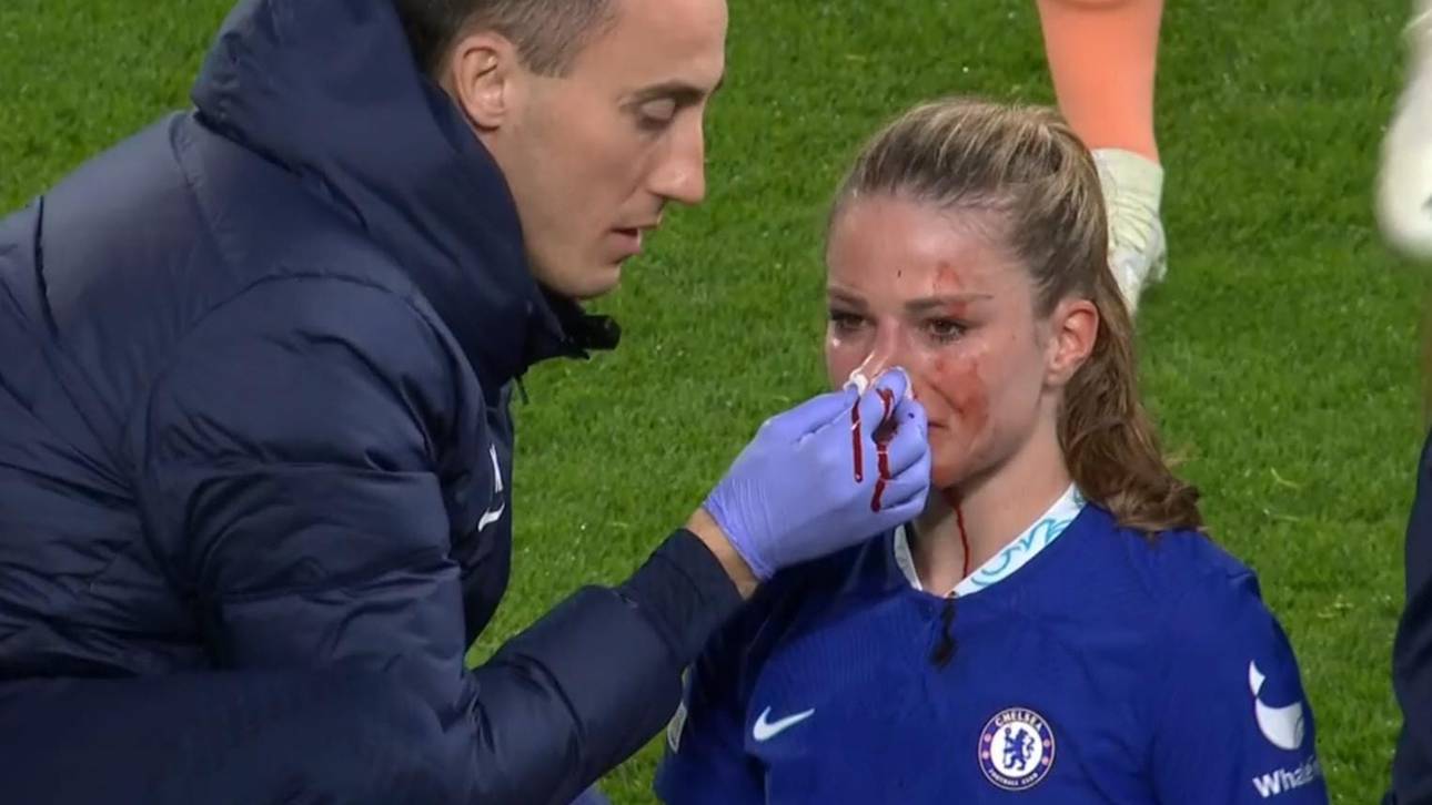 „Bloody Mel!“ Schockszene um DFB-Star