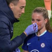 Melanie Leupolz wird beim dramatischen Halbfinal-Einzug des FC Chelsea blutend ausgewechselt. Eine andere deutsche Spielerin wird in der Champions League zur späten Heldin. 