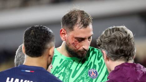 PSG-Kapitän Marquinhos versteht nicht, wie der Monegasse Wilfried Singo nach dem Tritt in das Gesicht von Gianluigi Donnarumma nicht vom Platz gestellt werden konnte.