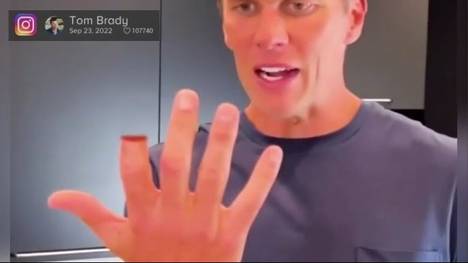 Diese Bilder sorgen für einen Schockmoment bei allen Football-Fans! Tom Brady hackt sich bei einem Kochtutorial den Finger ab.