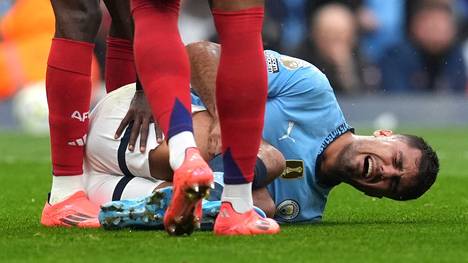 Nach der Horror-Diagnose für Rodri, welche für den Spanier das Saison-Aus bedeutet, macht Pep Guardiola klar, dass Manchester City keinen vergleichbaren Spieler hat.